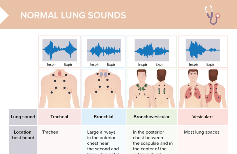 Charting Lung Sounds [+ Free Cheat Sheet] | Lecturio Nursing