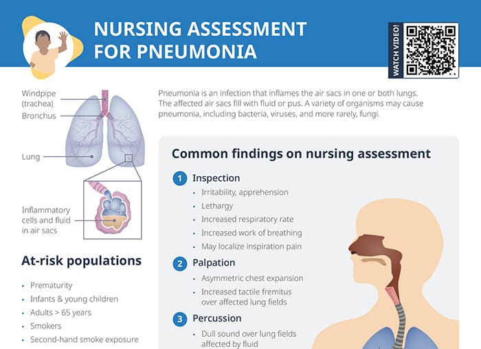 Nursing cs nursing assessment for pneumonia