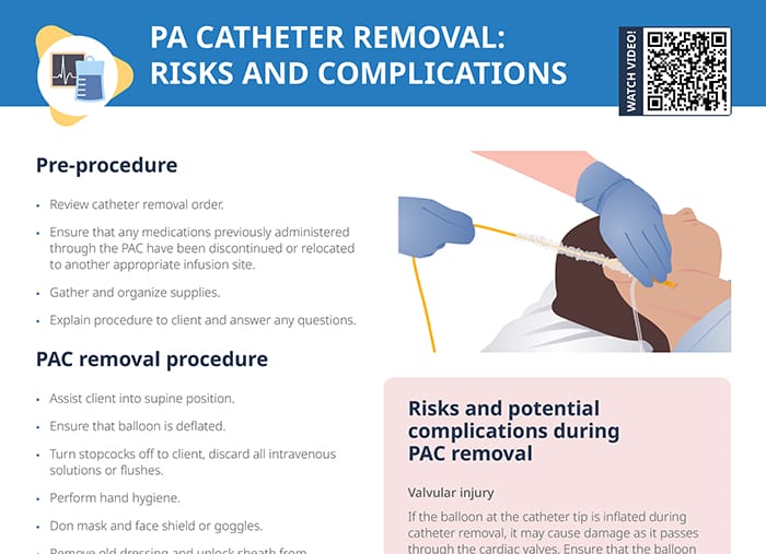 Pa catheter removal: risks and complications