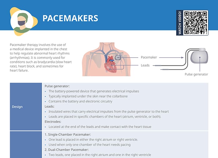 Overview of pacemakers, types, functions, and complications with use