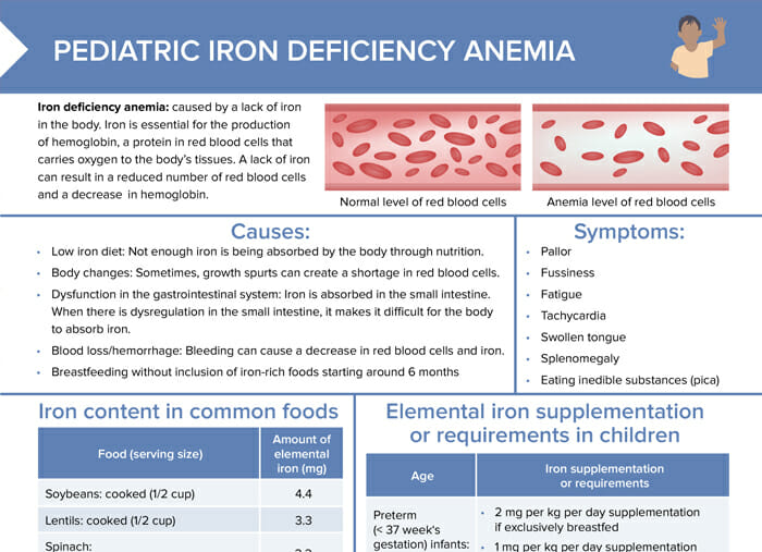Iron deficiency in children at a glance