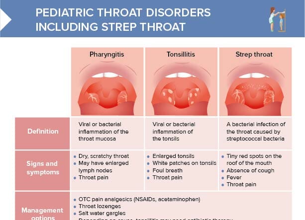 A comparison of pharyngitis, tonsillitis, and strep throat