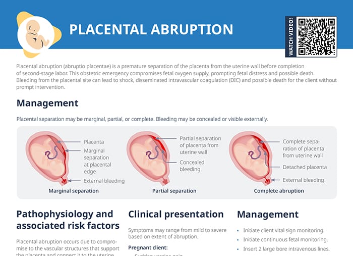 Overview of placental abruption: types, risk factors, clinical presentation, and management