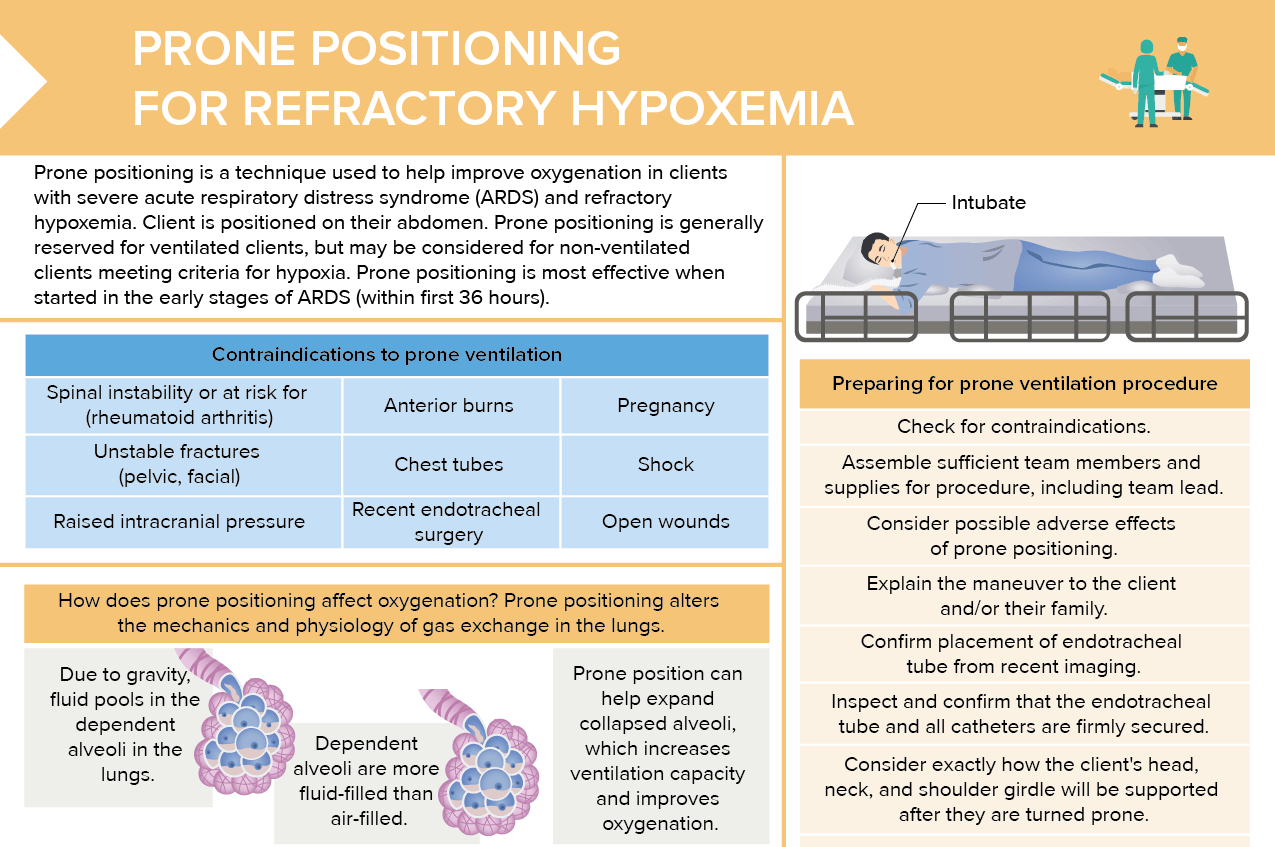 Nursing cs prone positioning for refractory hypoxemia 02