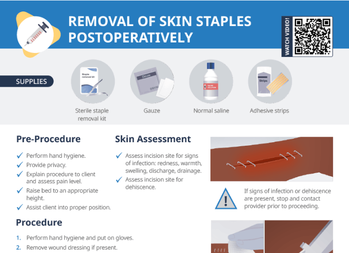 Thumbnail of Lecturio's Removal of skin staples post operatively Cheat Sheet
