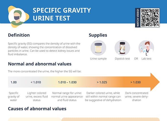 Specific gravity urine test