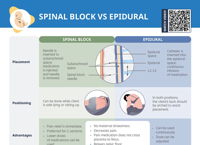 Overview of the placement, advantages, disadvantages and nursing interventions required for epidural vs. Spinal anesthesia