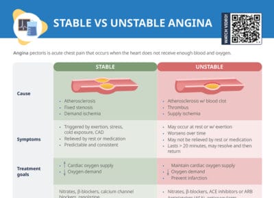 Stable vs unstable angina
