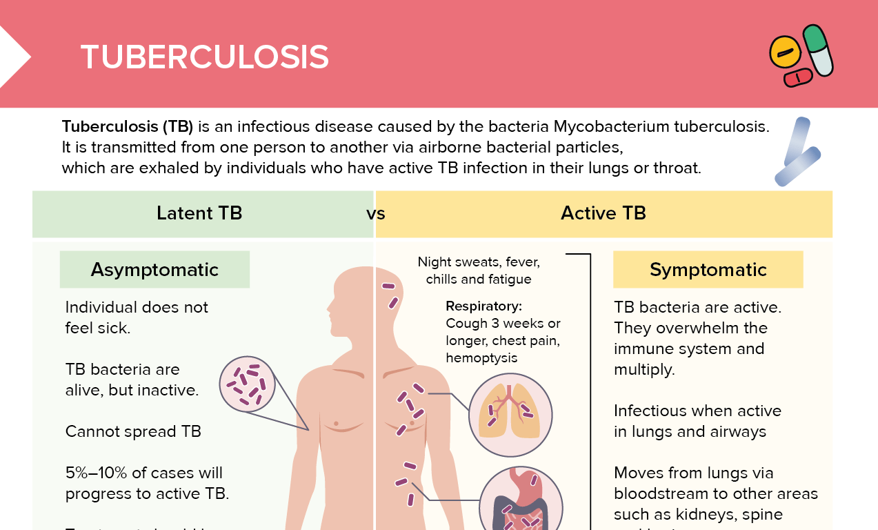 Tuberculosis Symptoms, Types, Causes, Risk Factors, 59% OFF