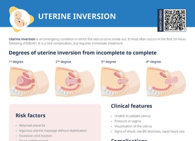 Uterine inversion: nursing overview