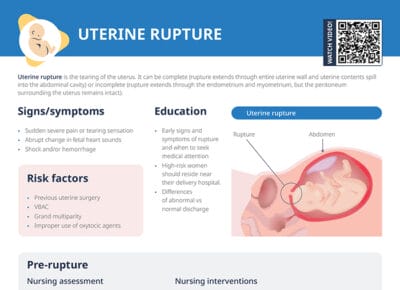 Uterine rupture is a rare but serious pregnancy complication involving the tearing of the uterus. The most common sign is an abrupt change in fetal heart sounds. Keep reading below for risk factors, more symptoms, and nursing assessments and interventions before and after uterine rupture.