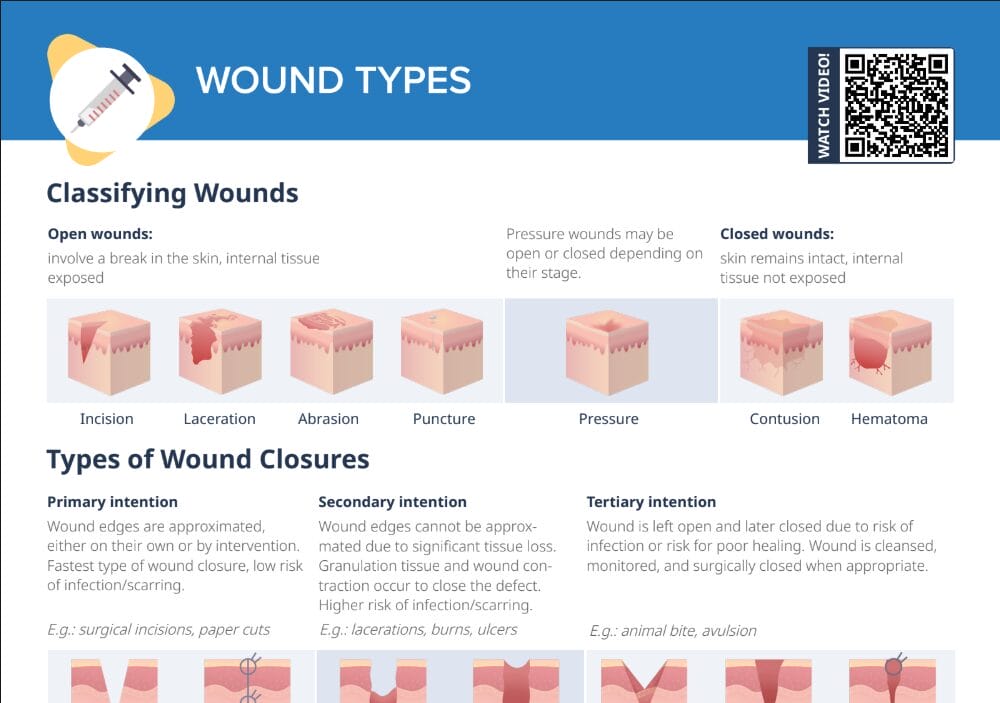 Thumbnail for Lecturio's Wound Types Cheat Sheet