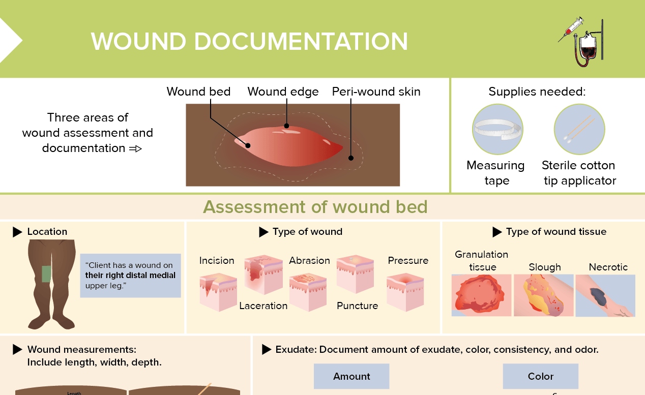 Review of complete wound assessment, including signs of abnormal healing