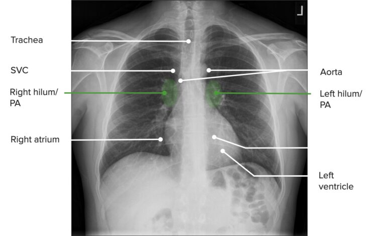 Imaging Of The Heart And Great Vessels | Concise Medical Knowledge