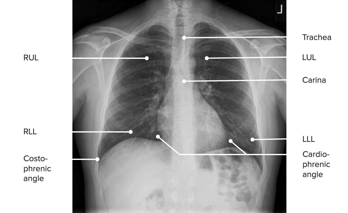 Pa projection of the chest