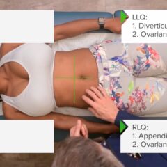 Palpation for abdominal tenderness in 4 quadrants
