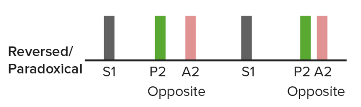 Paradoxical splitting of s2