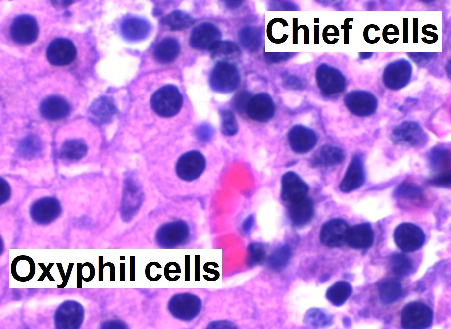 Células oxifilas y principales de las glándulas paratiroideas