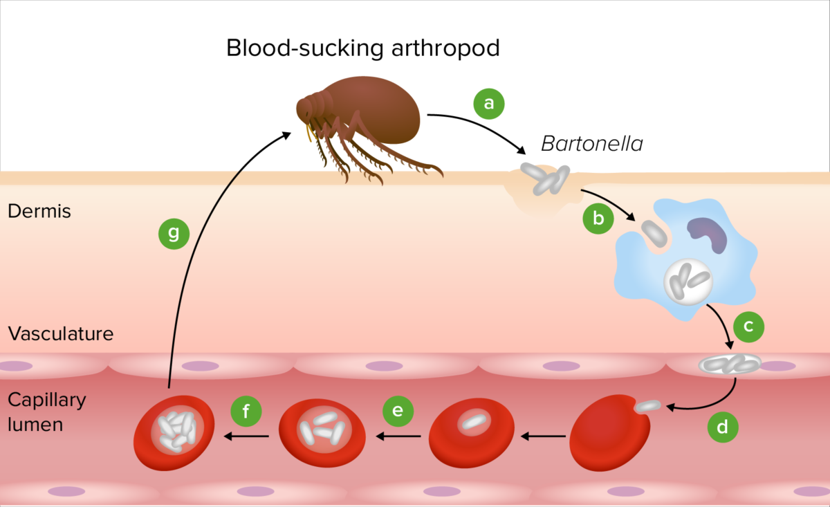 Patogenia de bartonella