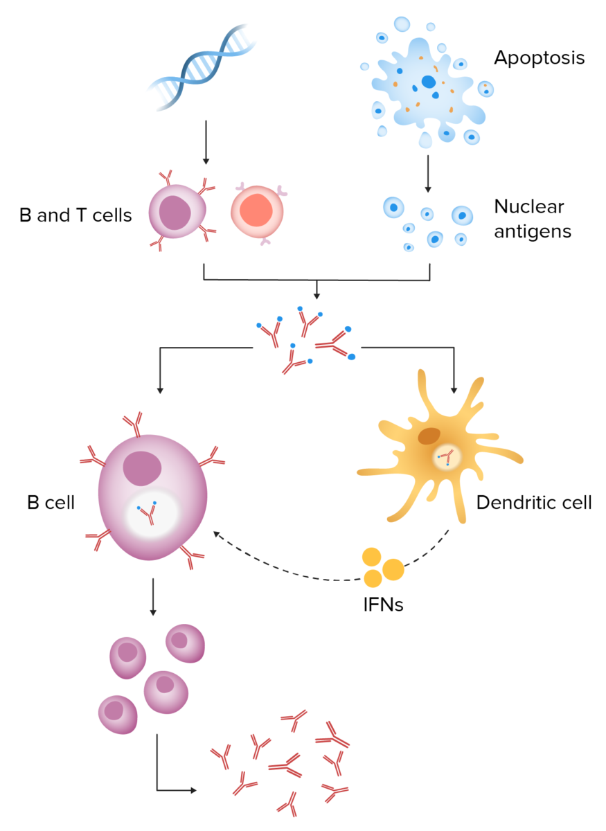 Pathophys of sle