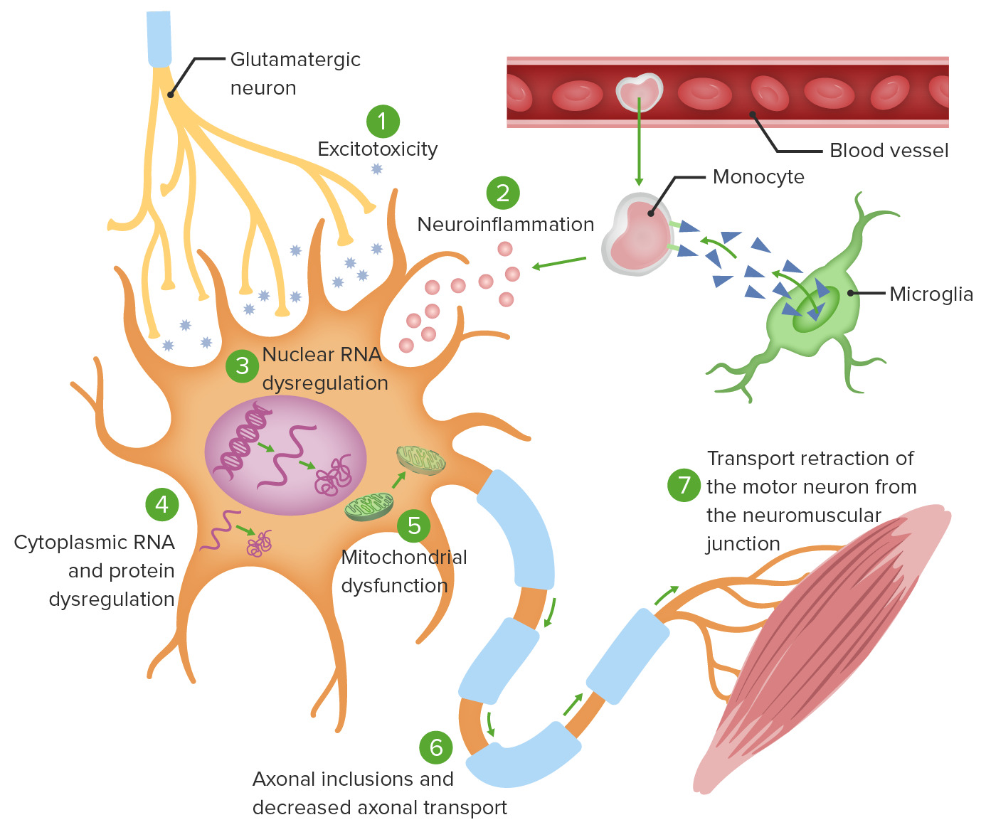 ALS (Lou Gehrig's Disease), Neurosciences