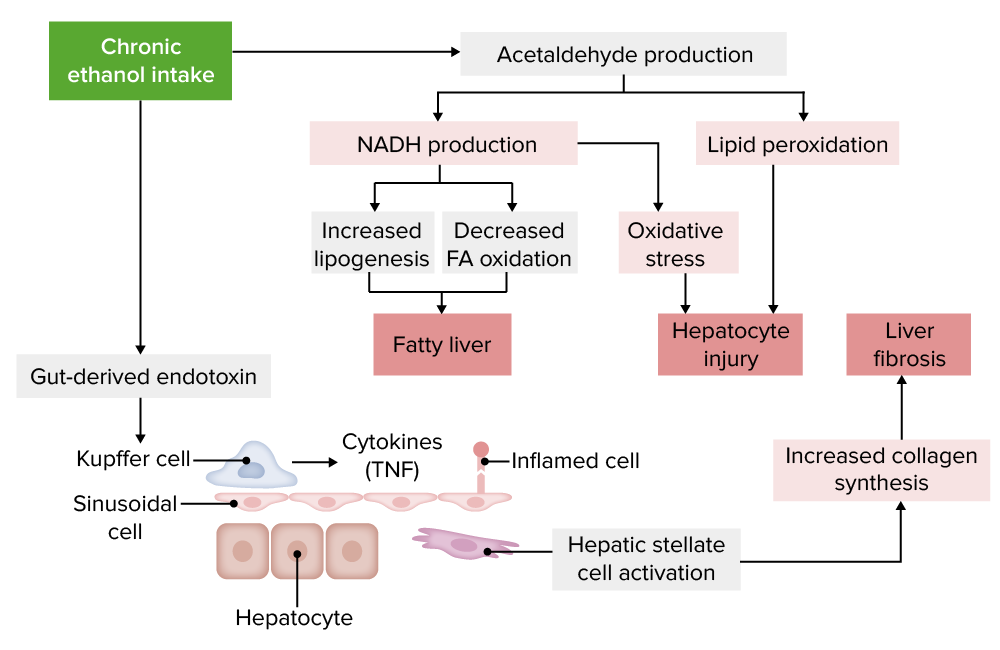 Pathophysiology of alcoholic liver disease