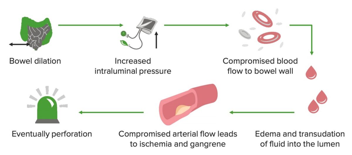 Pathophysiology of large bowel obstruction