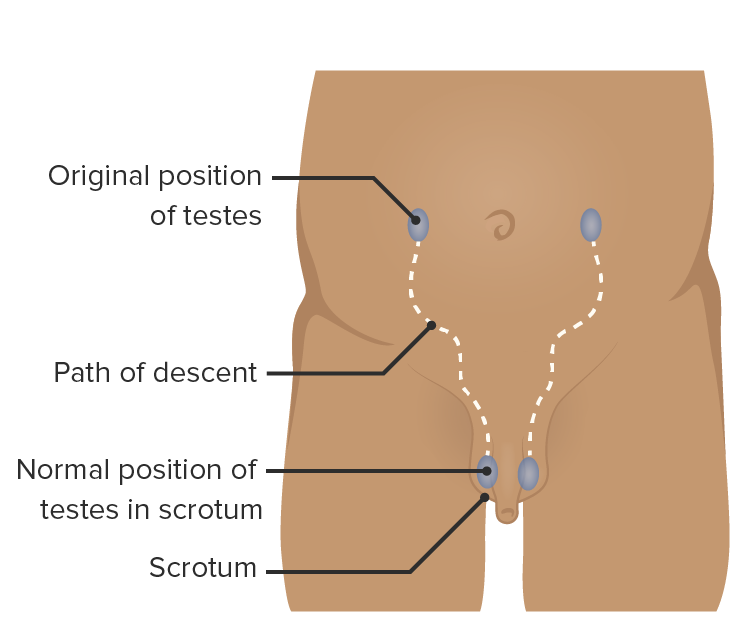 Vía de descenso testicular