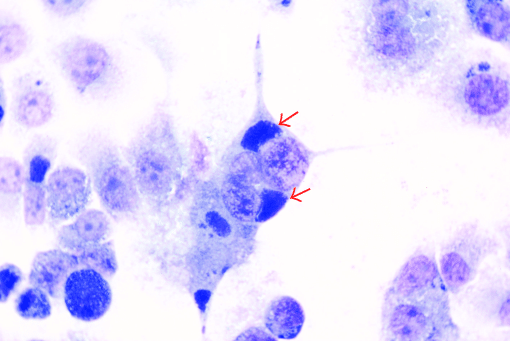 chlamydial inclusion bodies