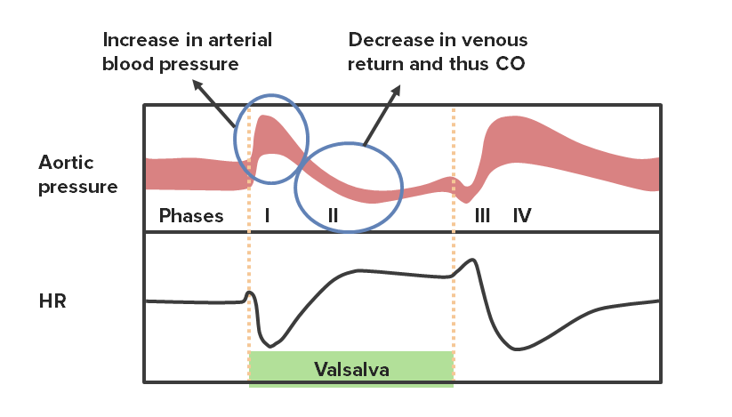 Phases of the valsalva maneuver with their corresponding changes in hr