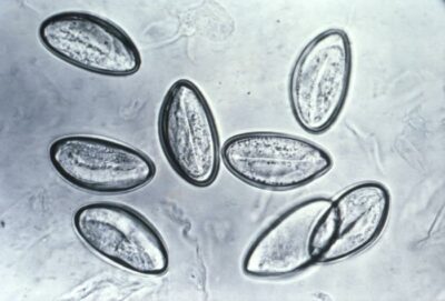 Photomicrograph enterobius vermicularis eggs enterobiasis