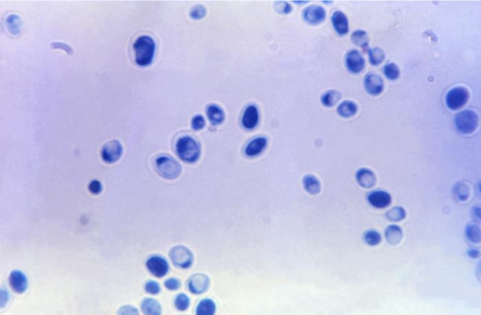 Photomicrograph of candida albincans in the yeast state