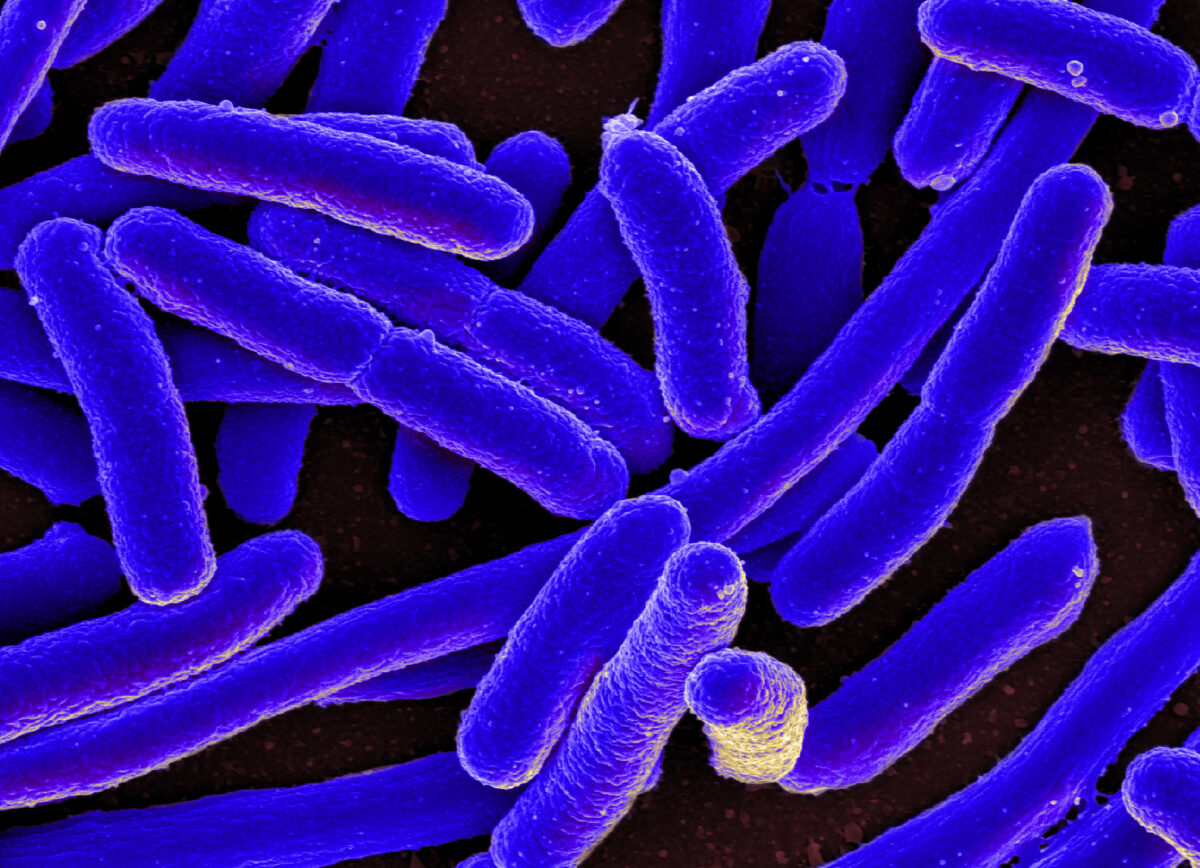 Fotomicrografia de escherichia coli