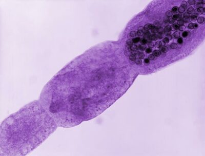 Photomicrograph of an echinococcus multilocularis tapeworm echinococcosis