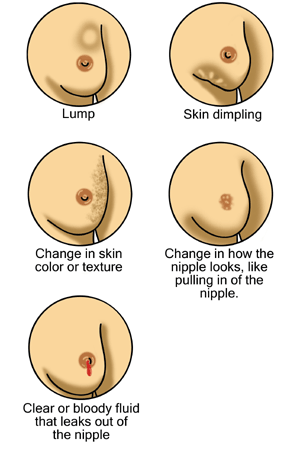 Breasts: Anatomy  Concise Medical Knowledge