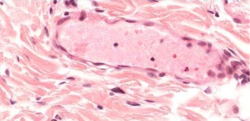 Post-capillary venule