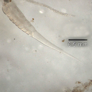 Posterior end enterobius vermicularis enterobiasis