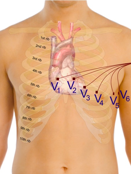 Precordial leads in ecg