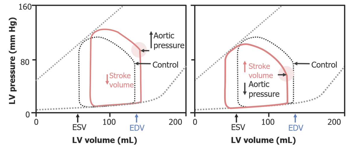 Pressure-volume loops illustrating effects of afterload
