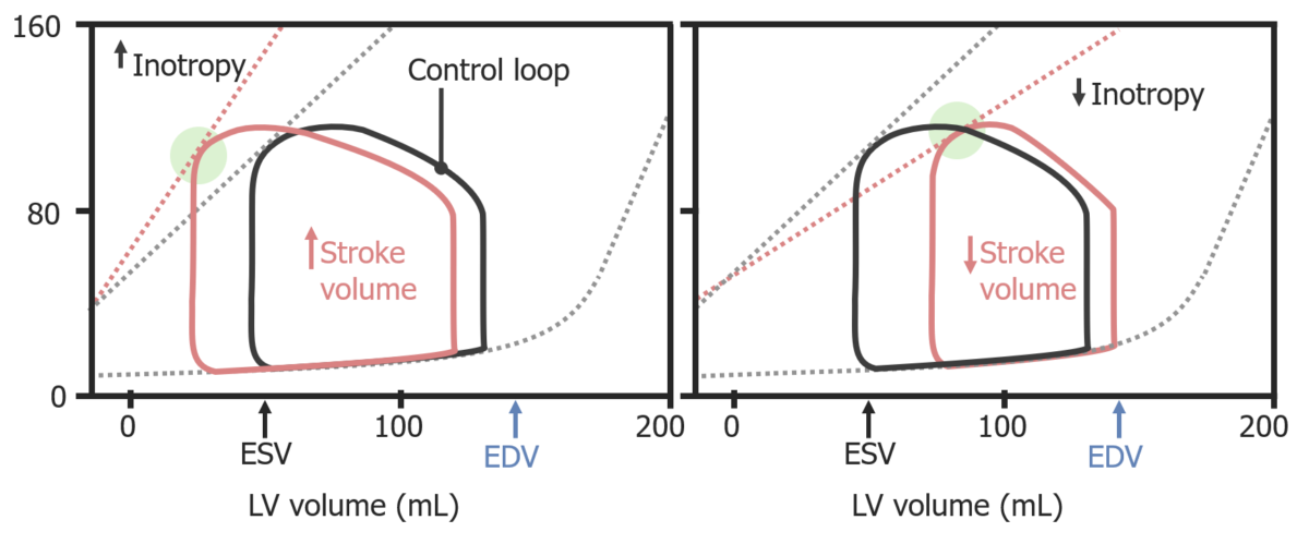Pressure-volume loops illustrating effects of inotropy