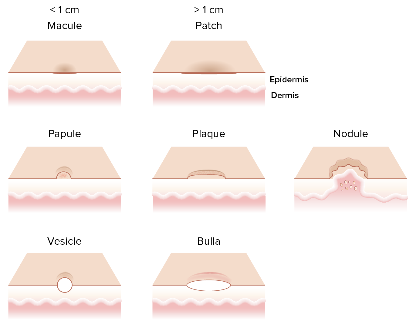 Primary Skin Lesions Concise Medical Knowledge