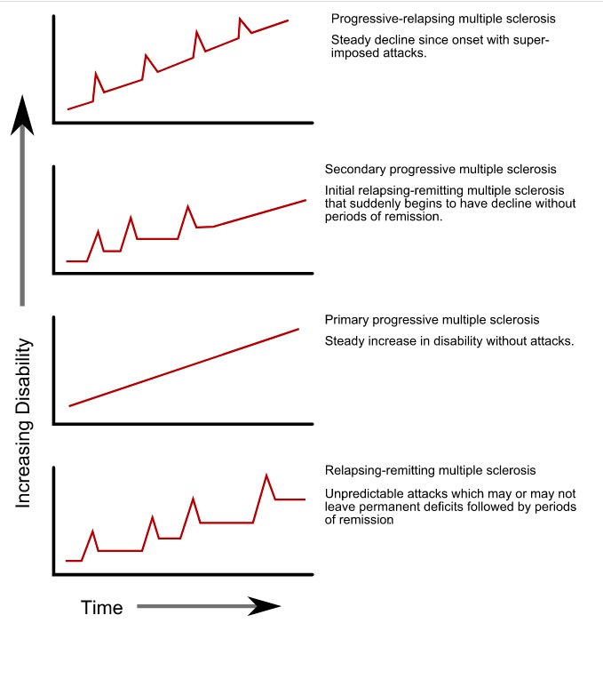 multiple sclerosis progression chart Multiple sclerosis