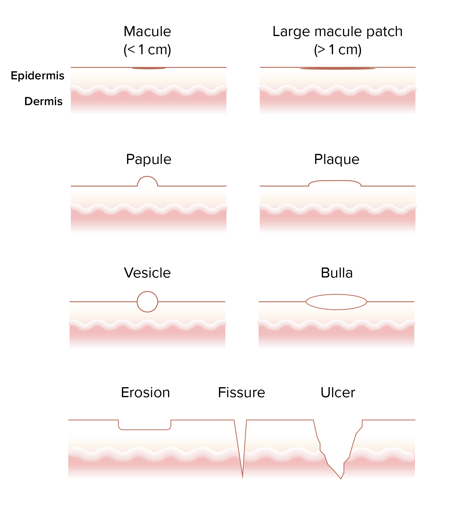 Generalized And Localized Rashes Concise Medical Knowledge