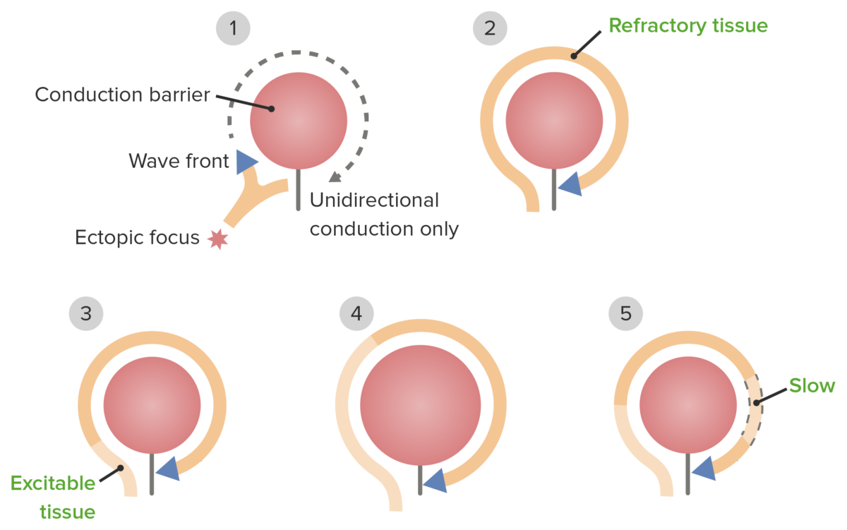 Re-entrant phenomena