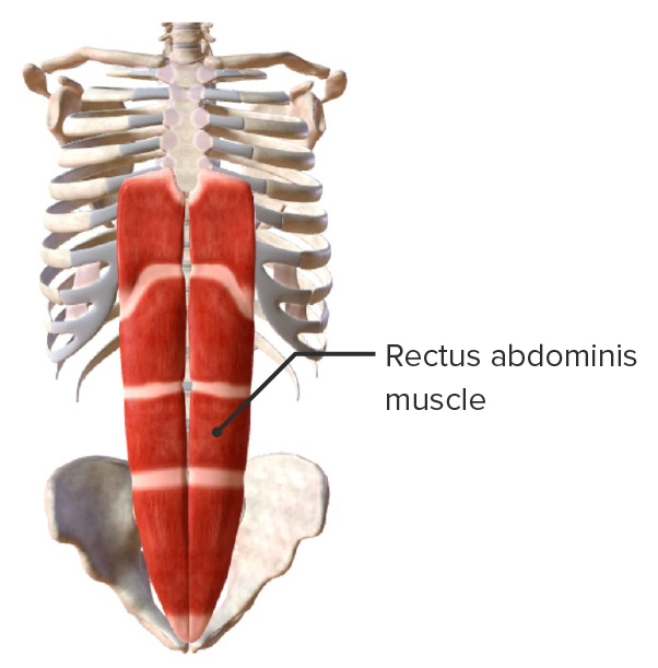 Músculo recto del abdomen
