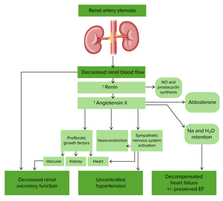 Renal Artery Stenosis | Concise Medical Knowledge