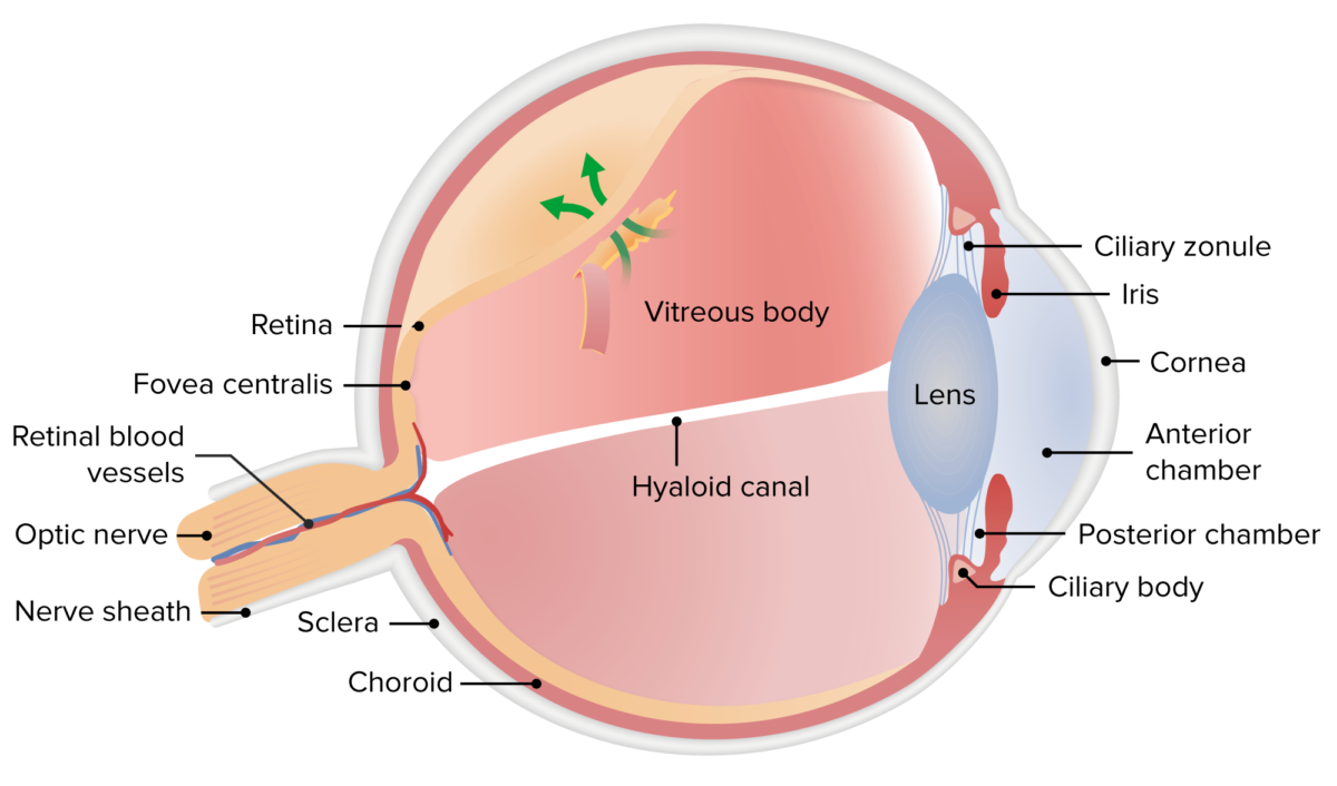 Descolamento da retina