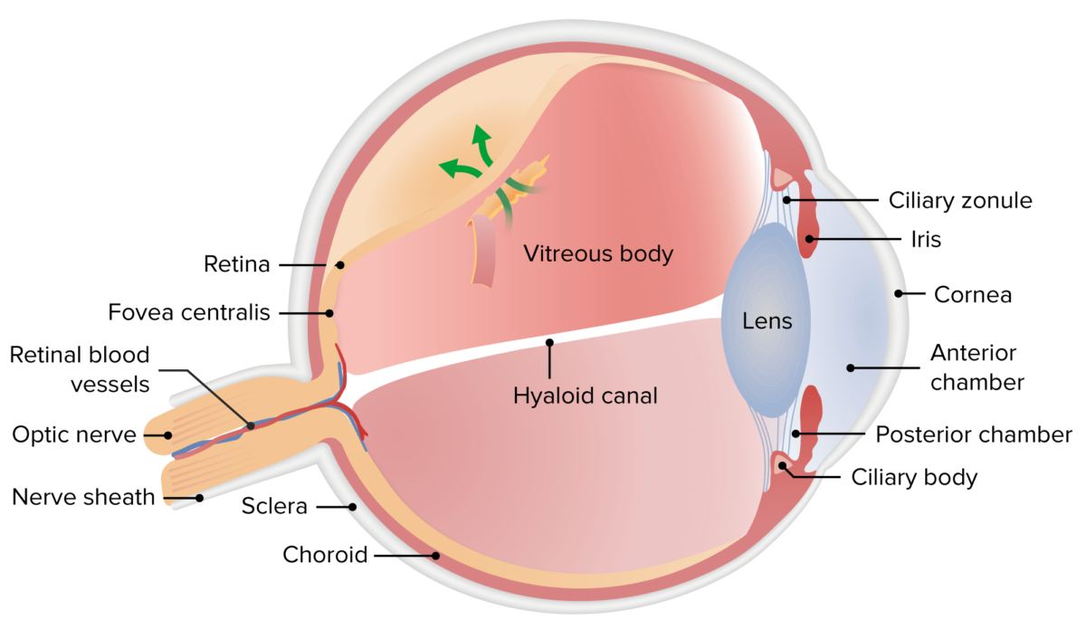 Retinal detachment