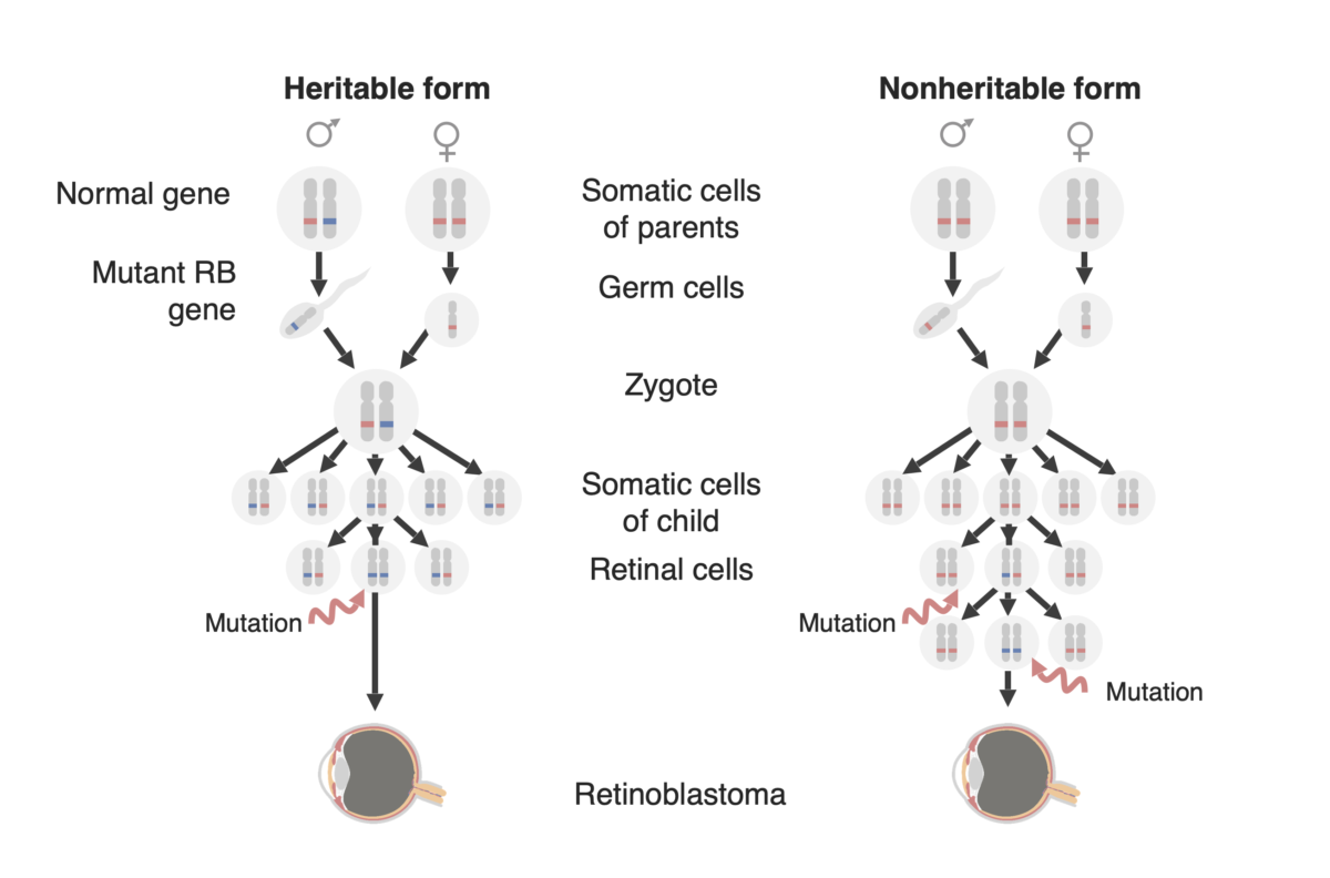 Retinoblastoma forms - heritable and nonheritable