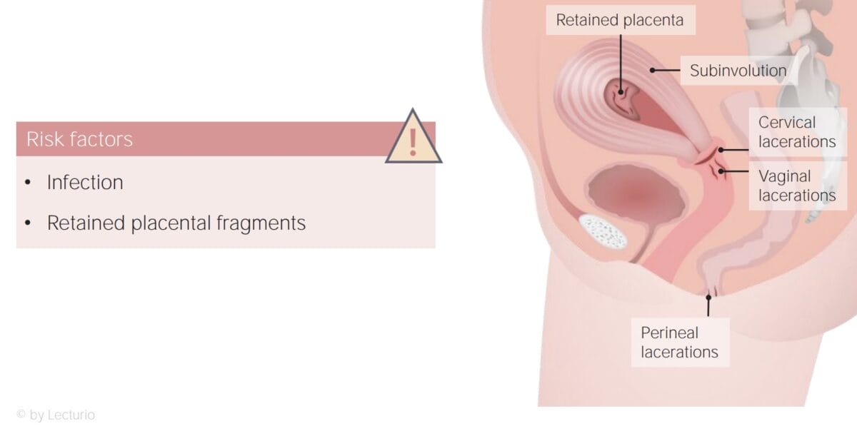 Review of uterine subinvolution defintion, risk factors, clinical features, diagnosis, nursing care and client education